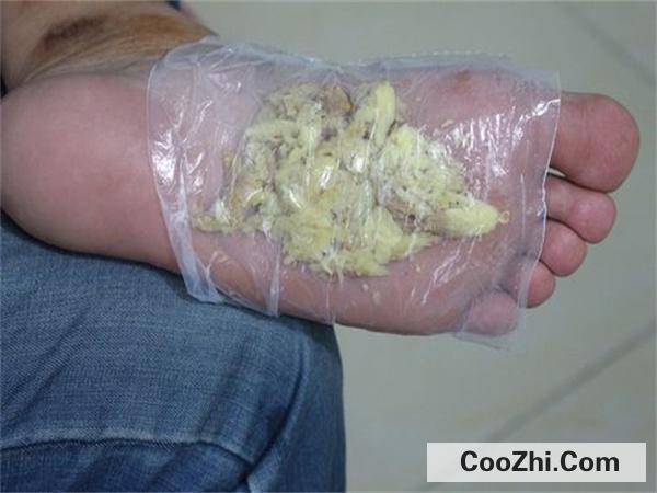 婴儿流鼻涕用姜敷脚心有没有用